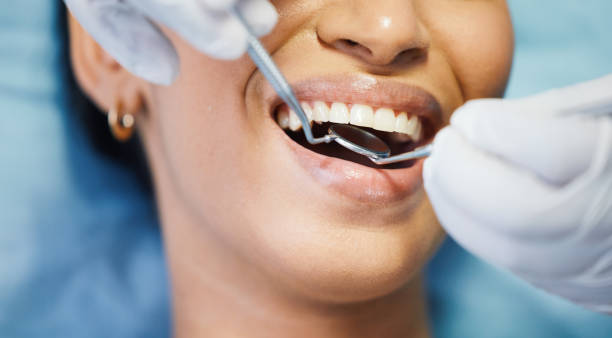 Best Emergency Root Canal Treatment in Syracuse, IN